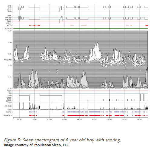 figure5-sleep-spectrogram-six-year-old-boy