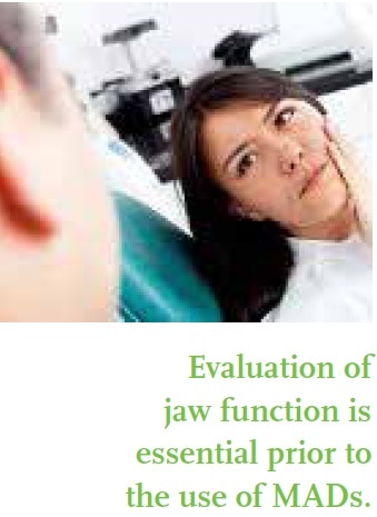 Two-piece mandibular advancement device without elastic retention