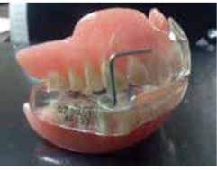 Ortho_Connect_Abrahamson_dentures