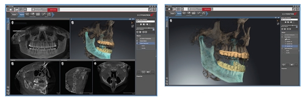 Left: For the First Time GALILEOS Provides True Motion in Cone Beam with SICAT Function - only from Siron. Right: New Perspectives for TMD Diagnostics.