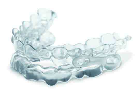 Digital workflows for oral appliance therapy