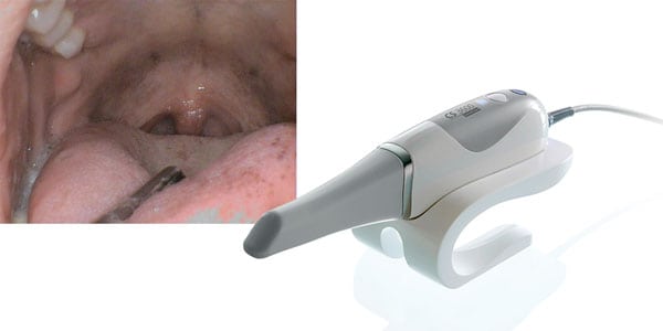 Digital workflows for dental sleep practices