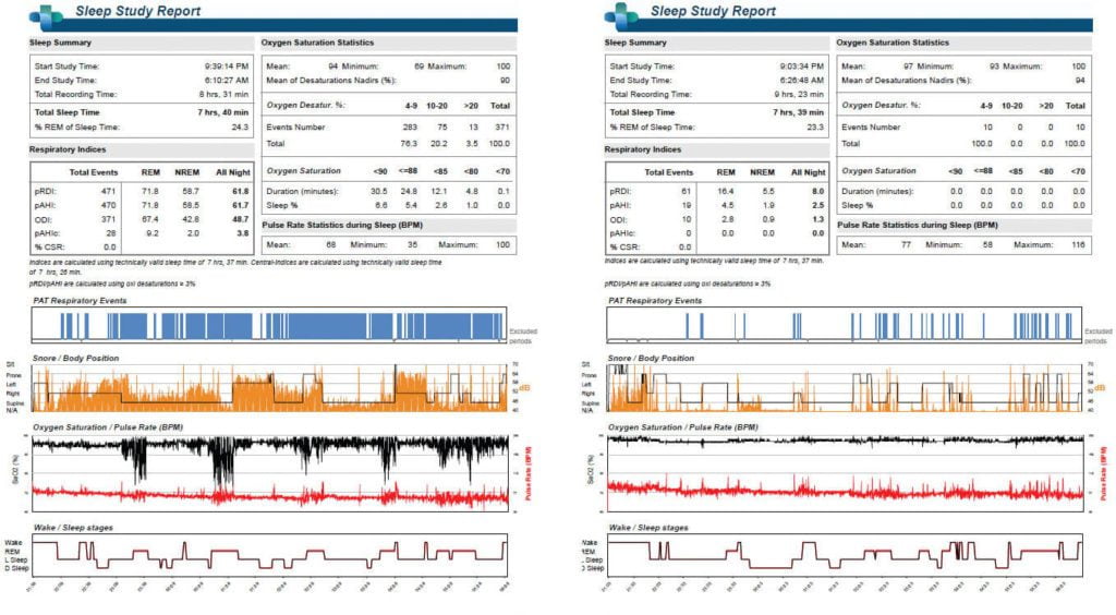 hybrid-therapies-lead-to-efficient-treatment-of-sleep-disorders