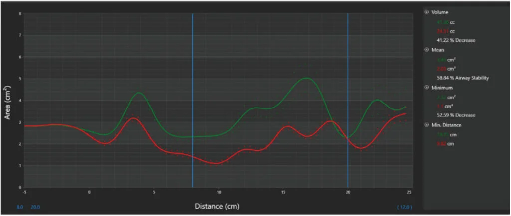 Technology and dental sleep