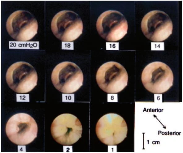 Technology and dental sleep