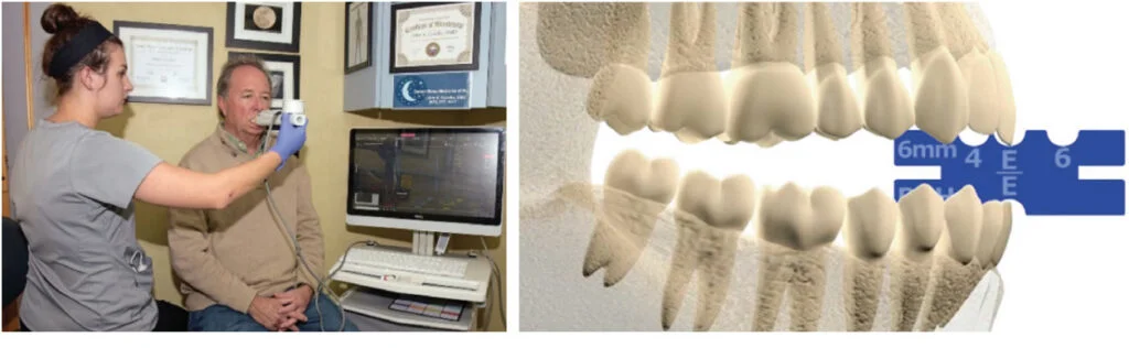 Technology and dental sleep