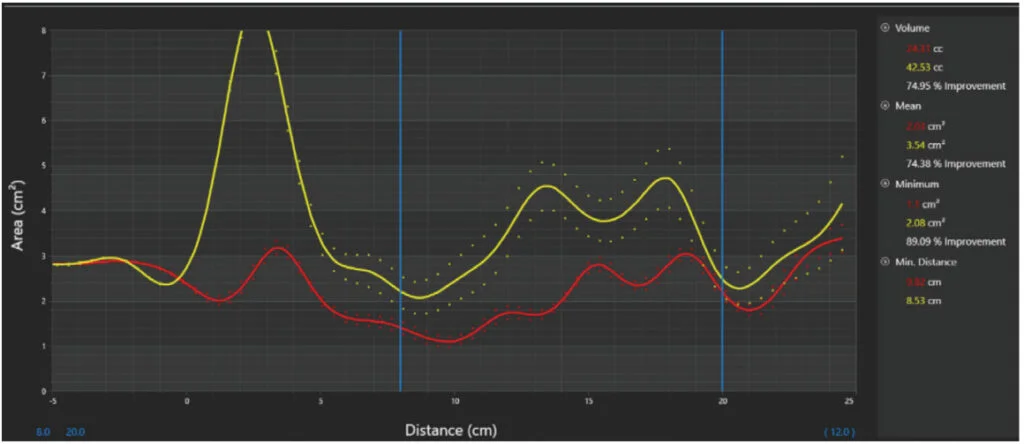 Technology and dental sleep