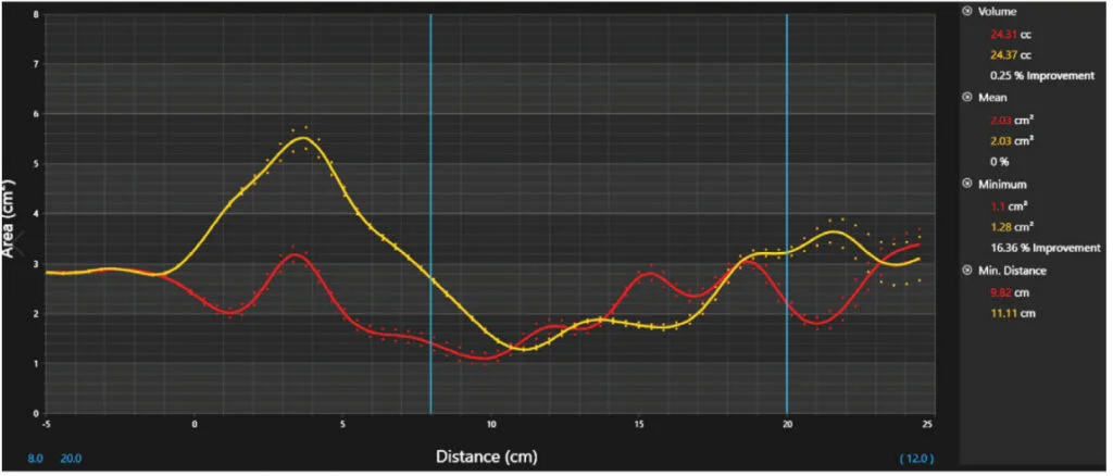 Technology and dental sleep