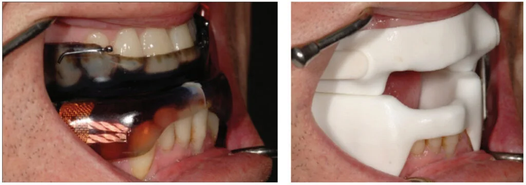 Technology and dental sleep