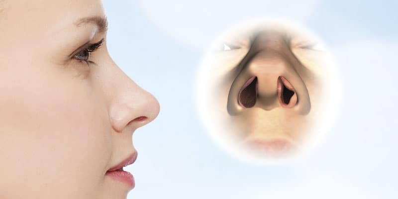 Nasal airway obstruction