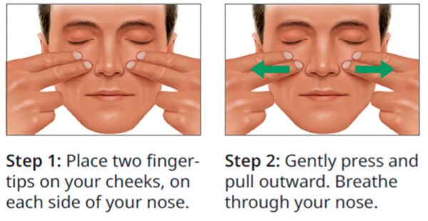 Nasal Airway Obstruction — a frequent reason for dental-sleep medicine ...