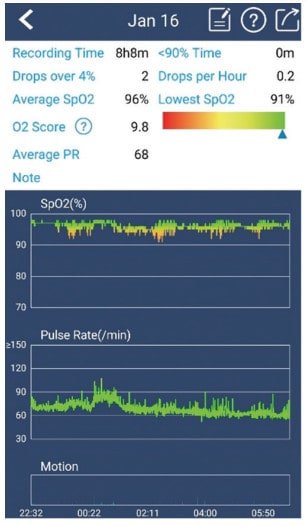 Slow Wave DS8 sleep appliance