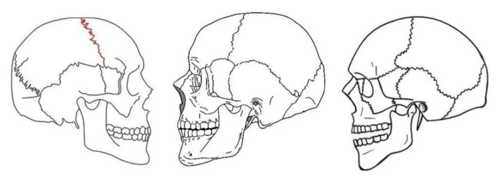 Design of oral appliance therapy