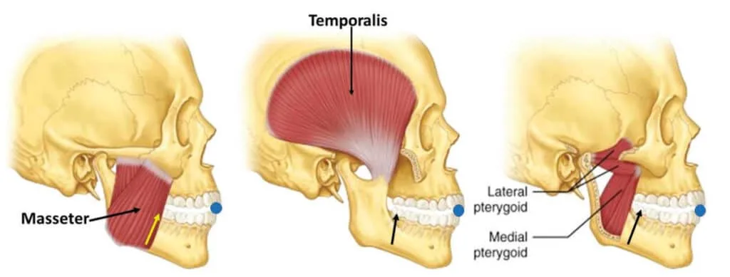 Design of oral appliance therapy