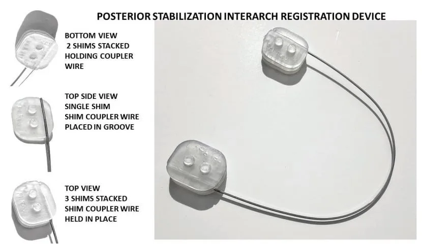 Design of oral appliance therapy