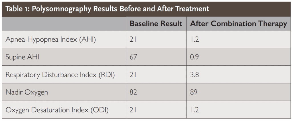 Table 1: Polysomnography Results Before and After Treatment Baseline Result After Combination Therapy Apnea-Hypopnea Index (AHI) 21 1.2 Supine AHI 67 0.9 Respiratory Disturbance Index (RDI) 21 3.8 Nadir Oxygen 82 89 Oxygen Desaturation Index (ODI) 21 1.2