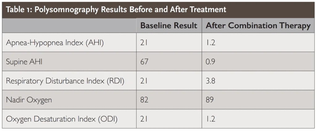 Table 1: Polysomnography Results Before and After Treatment Baseline Result After Combination Therapy Apnea-Hypopnea Index (AHI) 21 1.2 Supine AHI 67 0.9 Respiratory Disturbance Index (RDI) 21 3.8 Nadir Oxygen 82 89 Oxygen Desaturation Index (ODI) 21 1.2