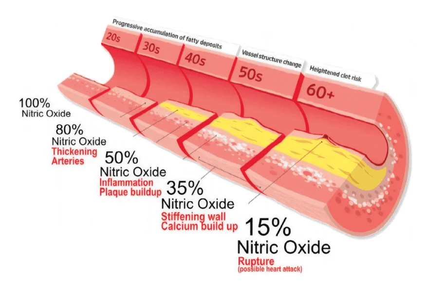 Nitric oxide