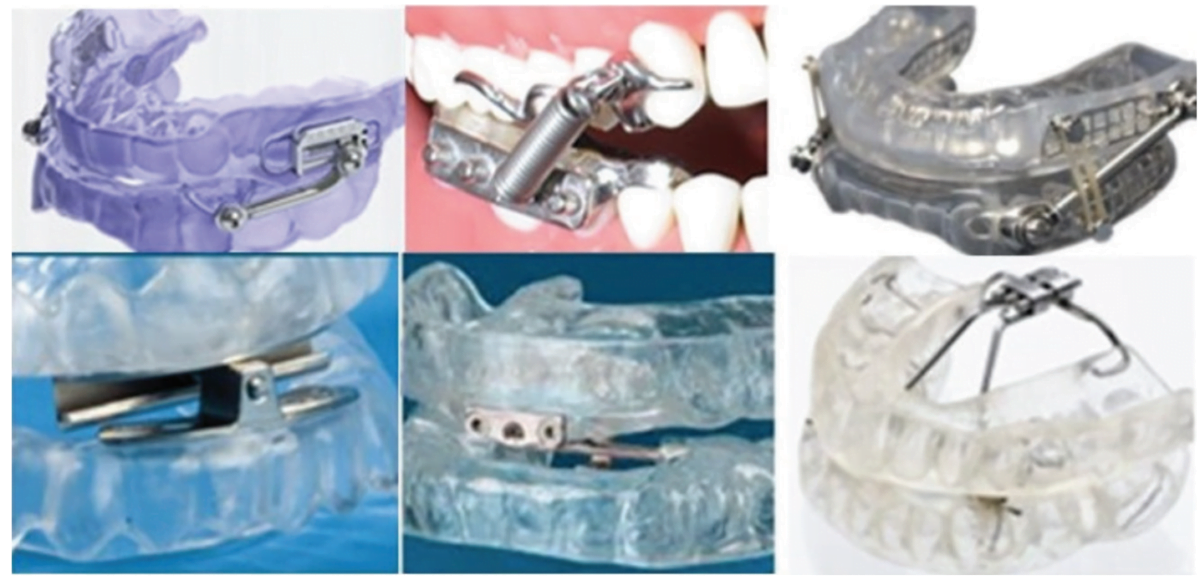 figure 4 a compilation of six commercially available, non ergonomic, non custom oral sleep