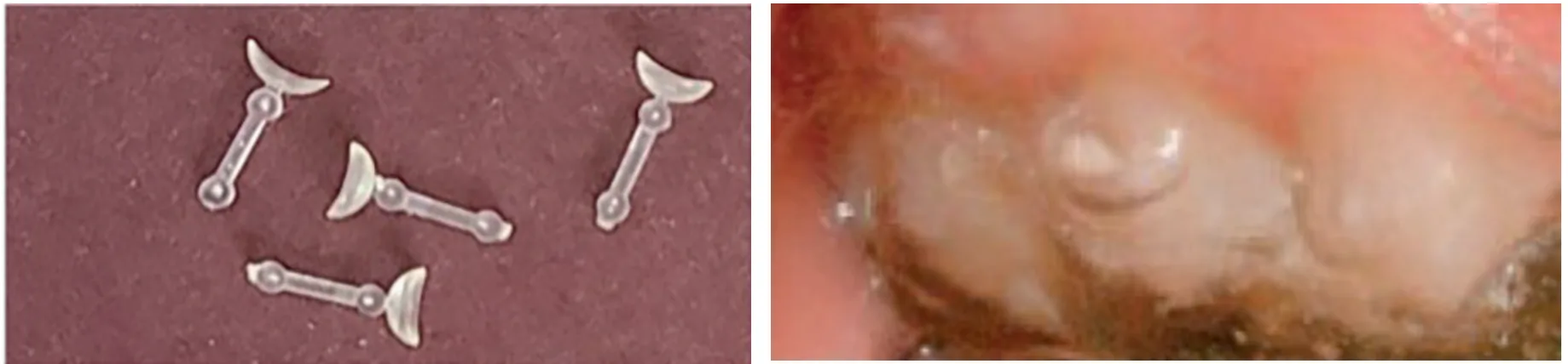 trutain crown contours