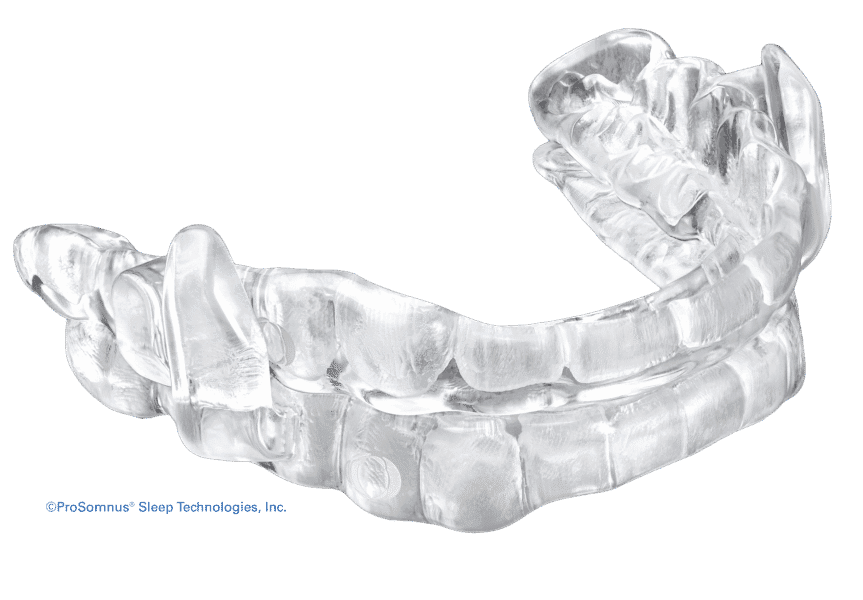 prosomnus evo guided sleep and snore device ©prosomnussleeptechnologies